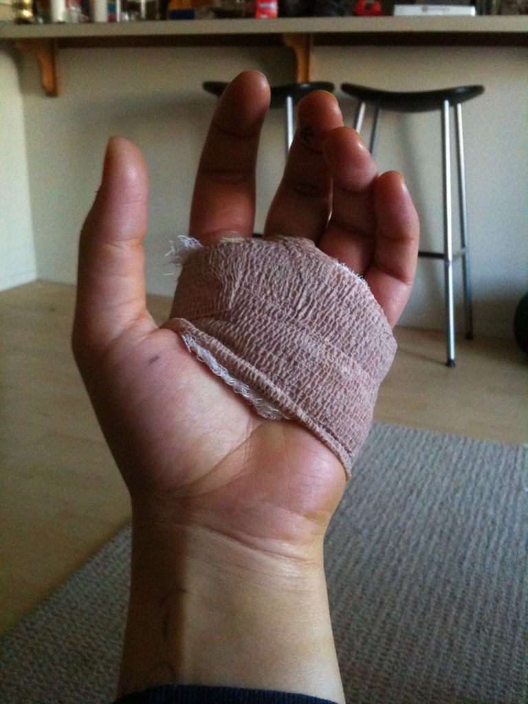 4 Common Plants That Heal Your Wounds