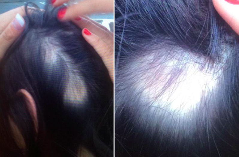 fda-investigates-shampoo-after-customers-lose-chunks-of-hair