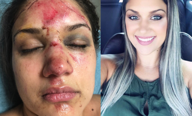 Woman Says She was Brutally Attacked Over Tubes on the Guadalupe