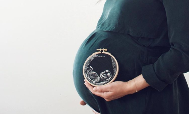 Turn Your Ultrasound Into a Cherished Keepsake With These Crafty Ideas