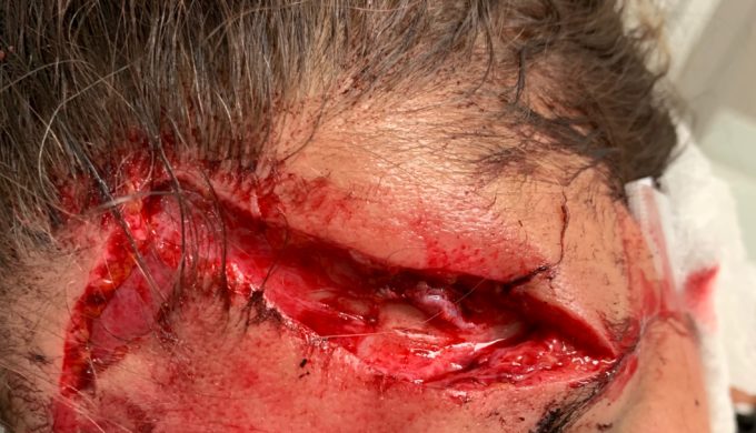 Woman Says She was Brutally Attacked Over Tubes on the Guadalupe Woman Says She was Brutally Attacked Over Tubes on the Guadalupe