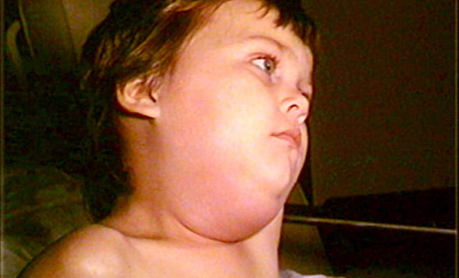 Dallas mumps